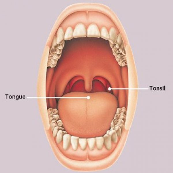 Mouth and Throat Cancer | Newfield Dental | Stamford Family Dental